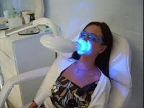 laser dentes branqueamento